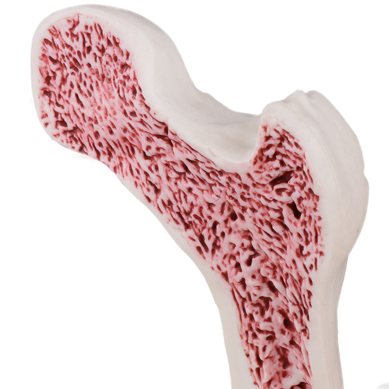 Pathological Osteoporosis Bone Model For Training