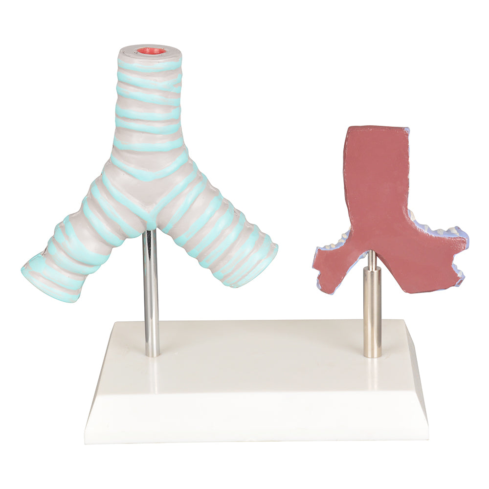 Patient Education Healthy Vs Smoker Bronchi