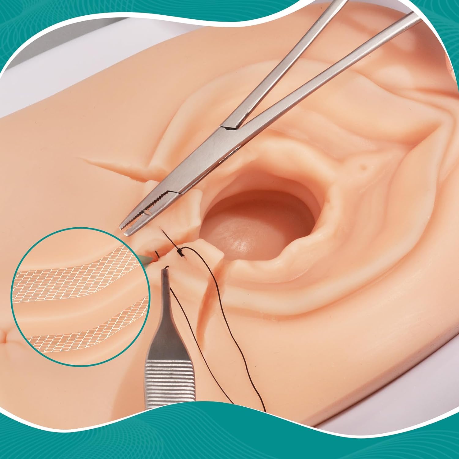 Perineal Suturing Model With Reinforced Protective Mesh