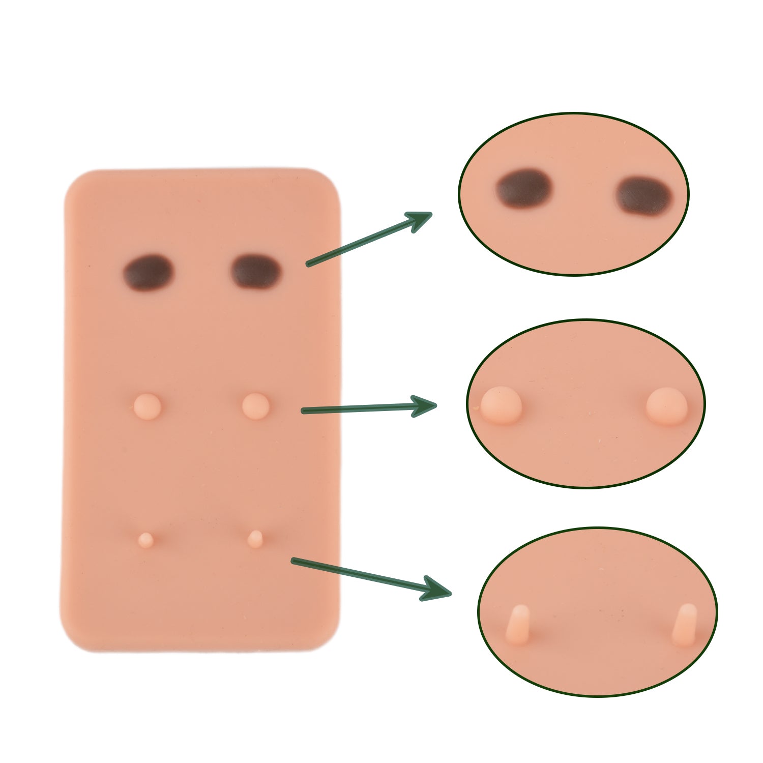 Pigmented Moles, Warts, Skin Tags Detail on Pad