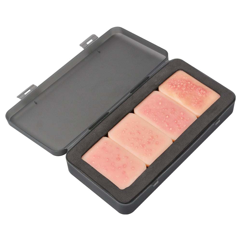 Professional Acne Pathology Teaching Model for Clinics