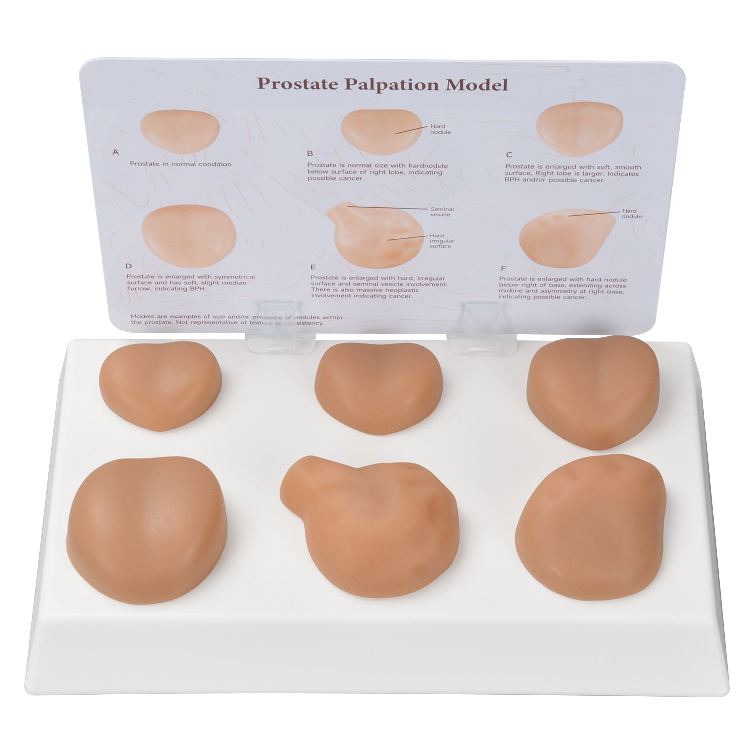 Prostate Palpation Education Model with Normal & 5 Pathologic Variants