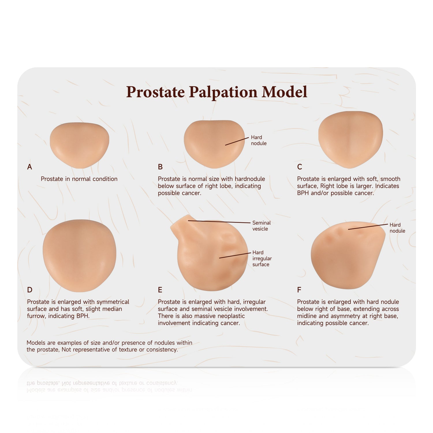 Prostate Palpation Trainer With Instruction Card Stand