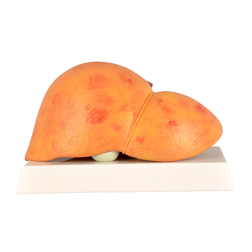 Realistic Alcoholic Fatty Liver Model