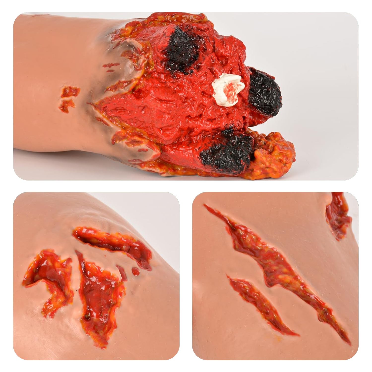 Realistic Amputated Arm Model For Emergency Training