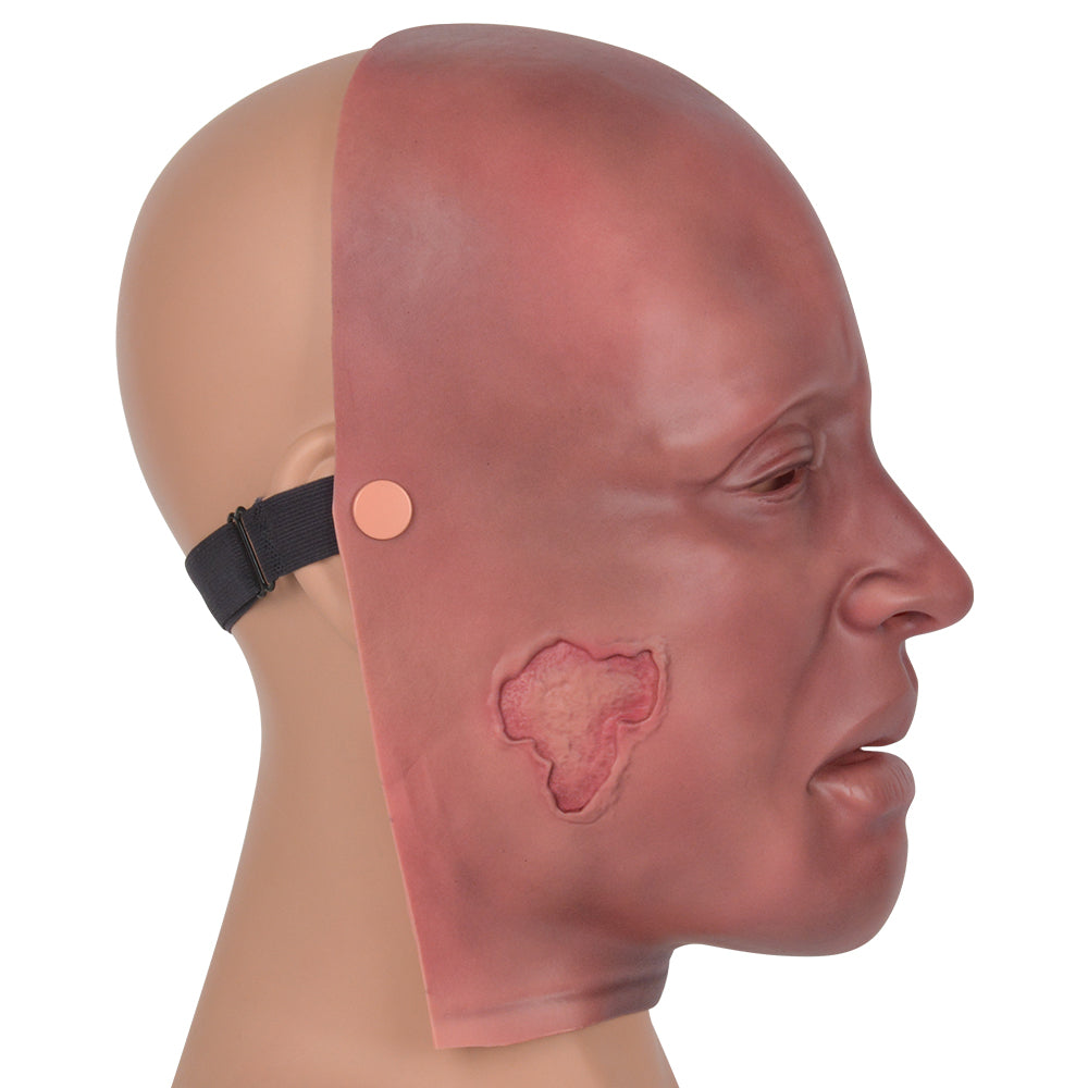 Realistic Burn Simulation Face Model