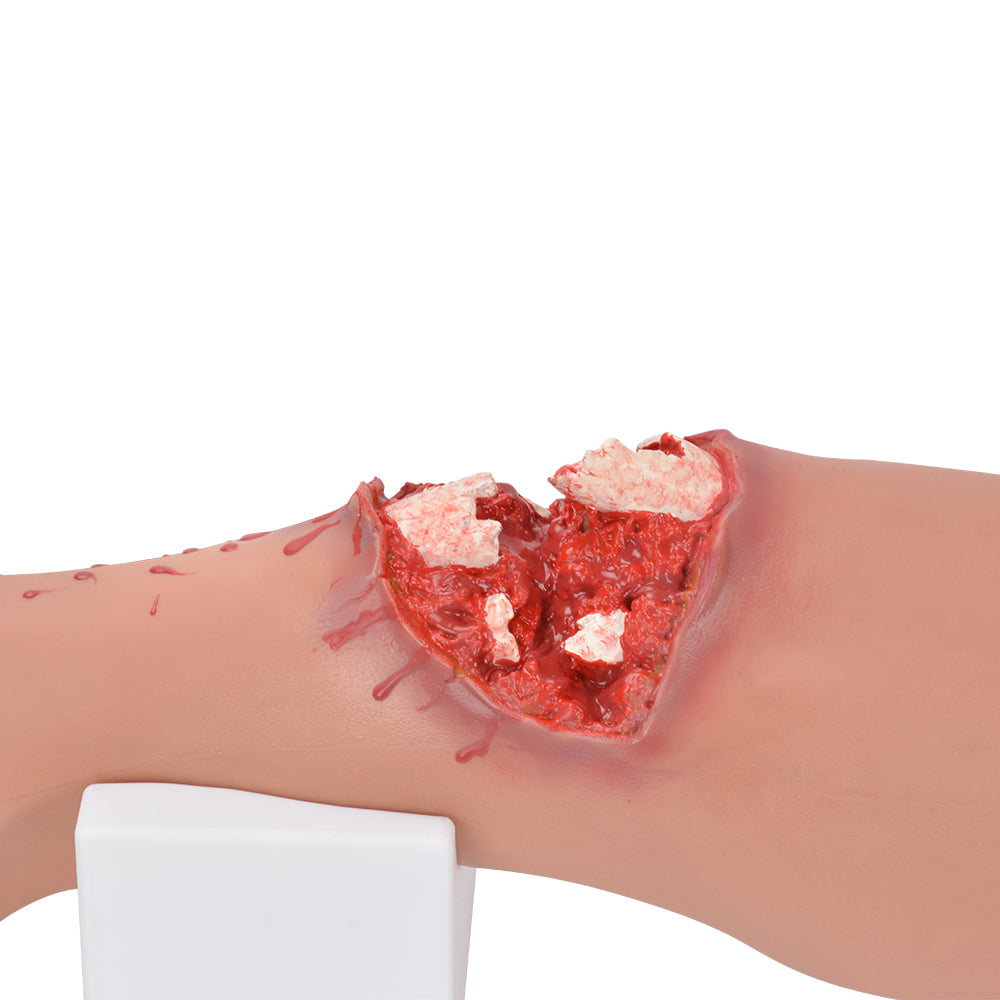 Realistic Low Leg Open Fracture Wound Simulator