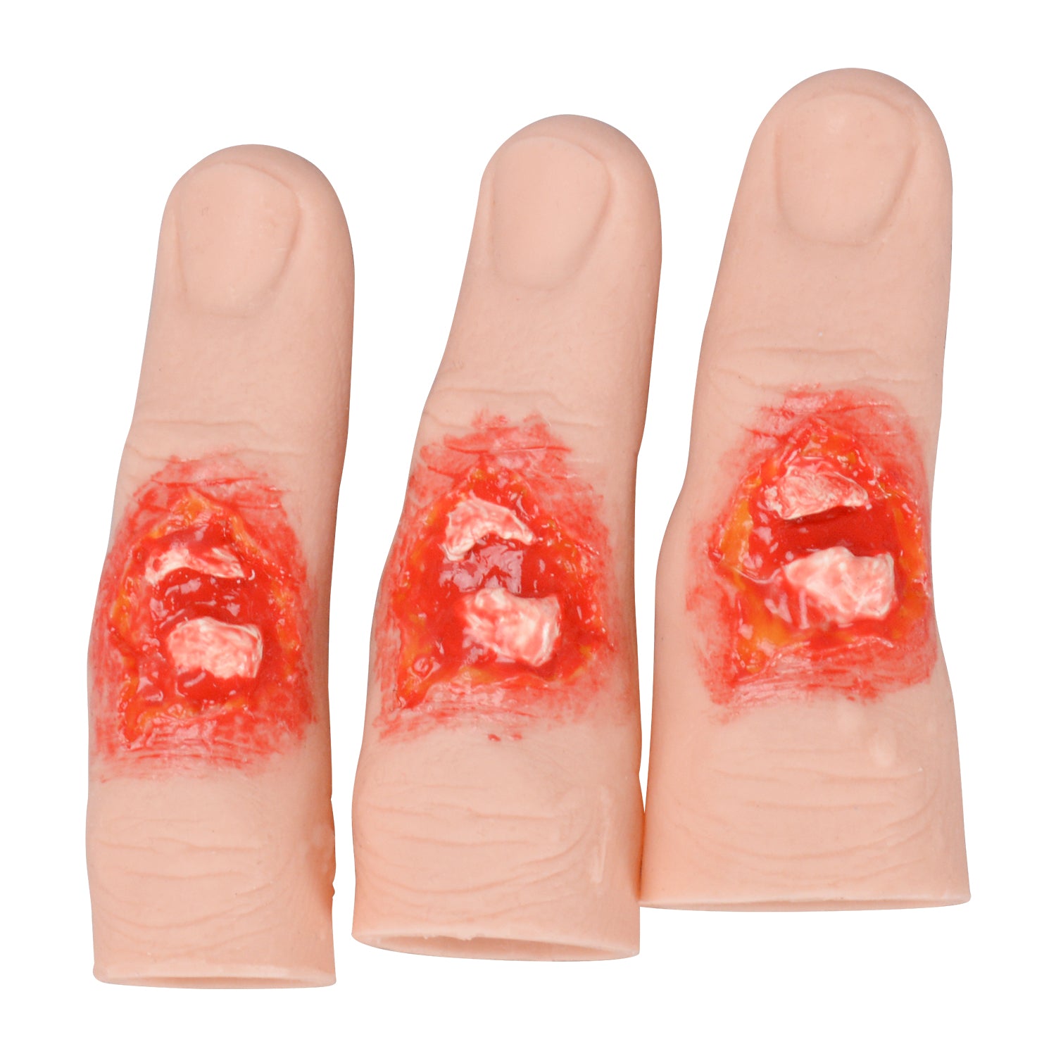 Realistic Open Bone Finger Trauma Simulator