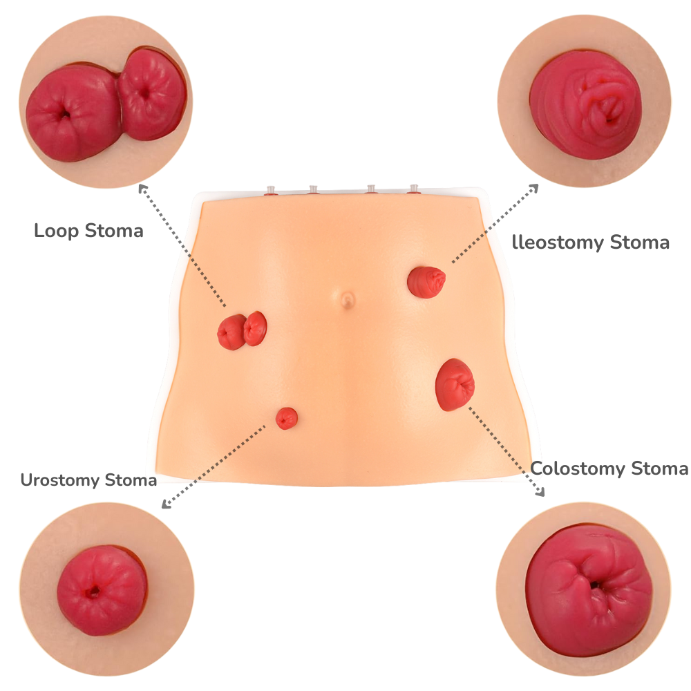 Realistic Ostomy Care Training Model
