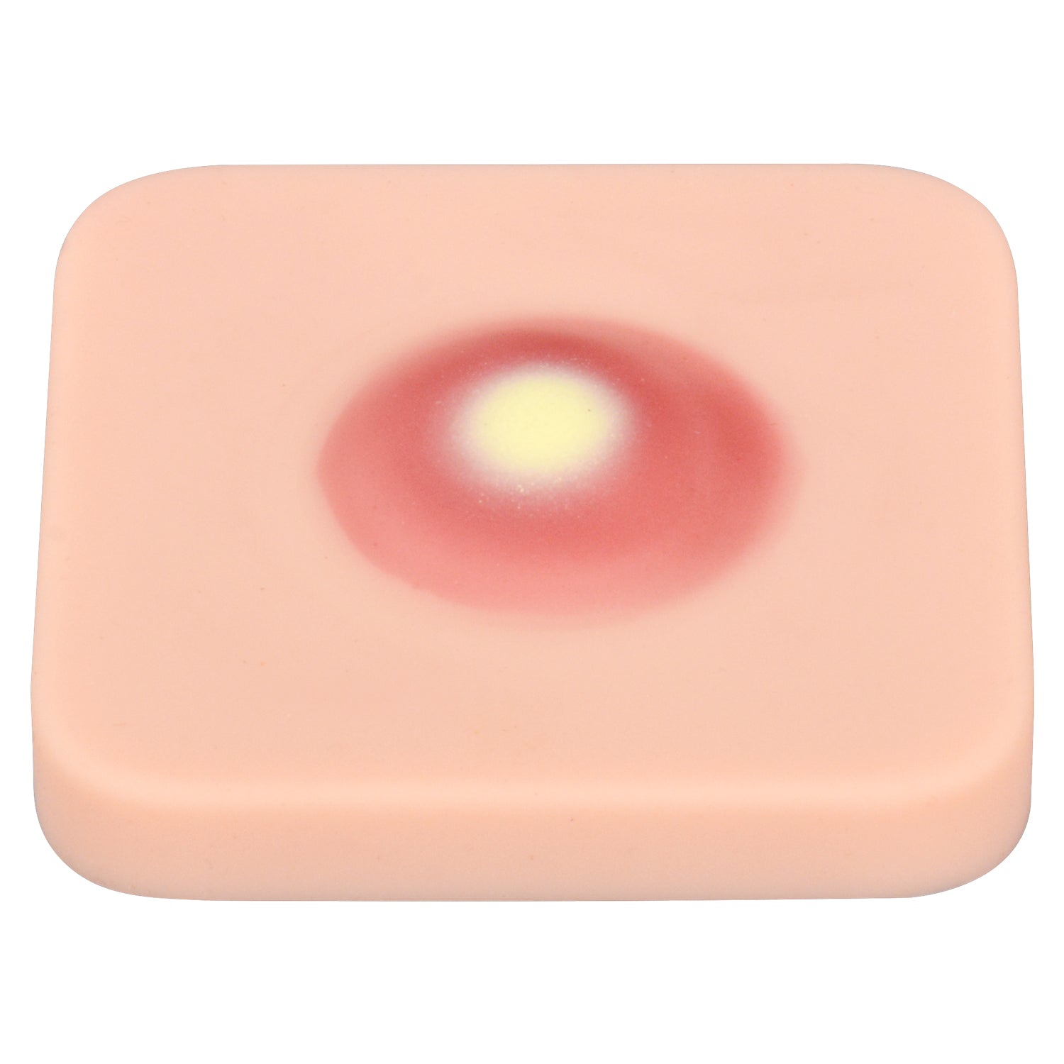 Realistic Skin Abscess Practice Pad For Clinical Skills