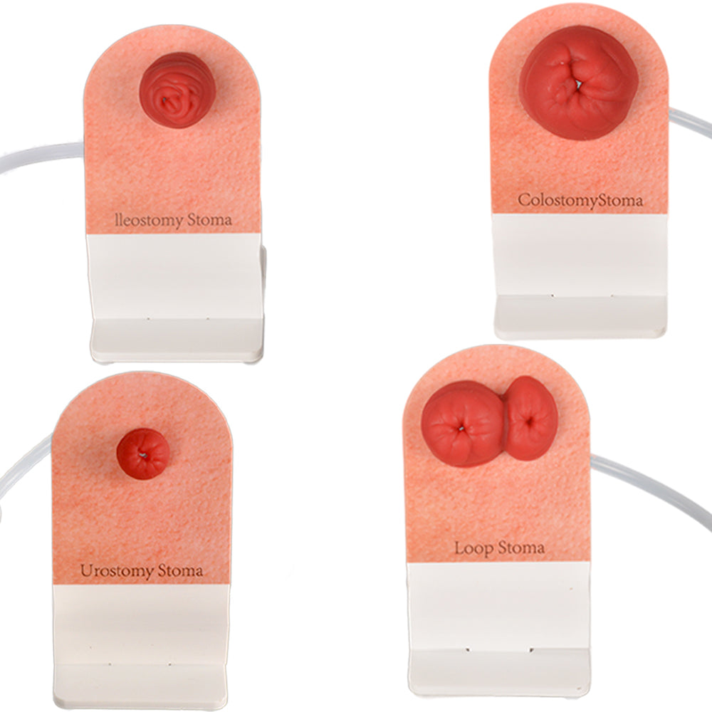 Realistic Stoma Models for Nursing Training
