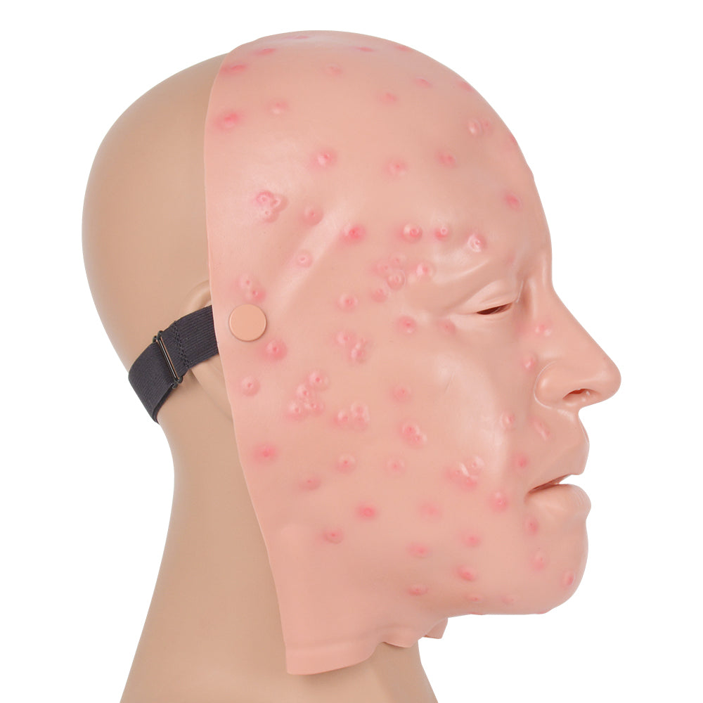 Realistic Wearable Mild Smallpox Face Model