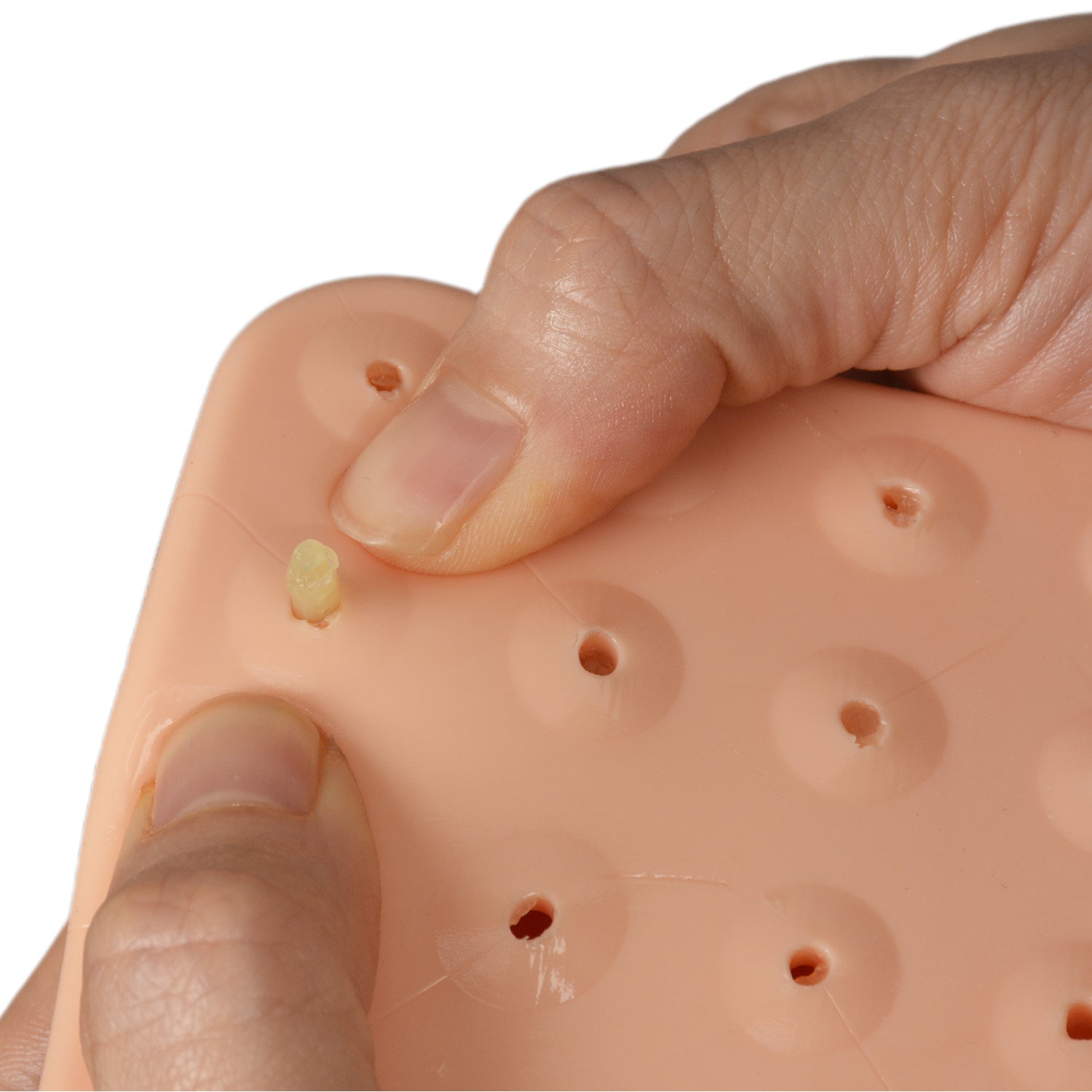 Refillable Pimple Practice Model