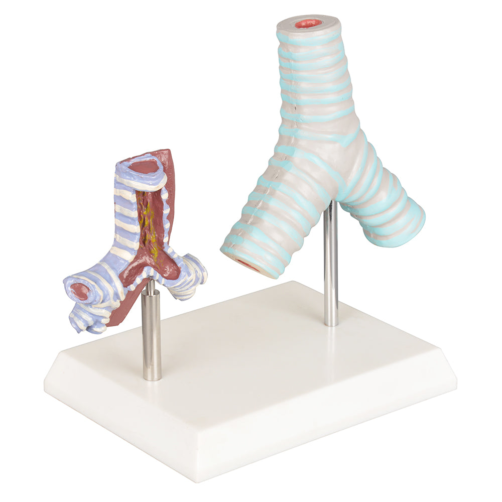 Respiratory System Model