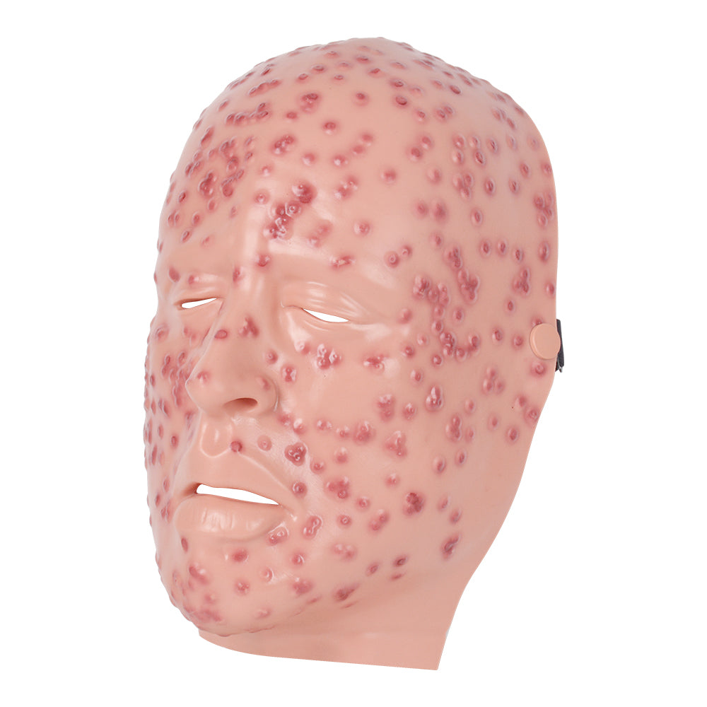 Scabbed Severe Smallpox Face Model