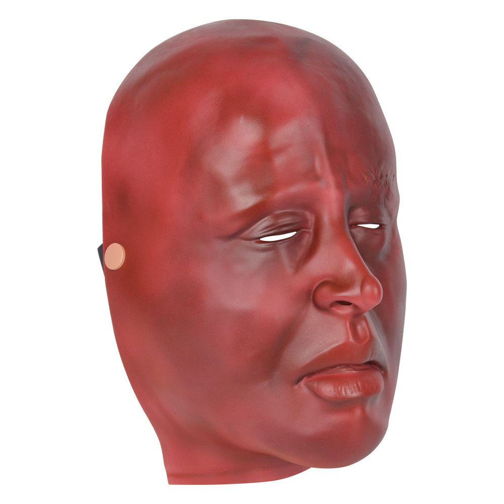 Severe Burn Face Model For Emergency Response Drills