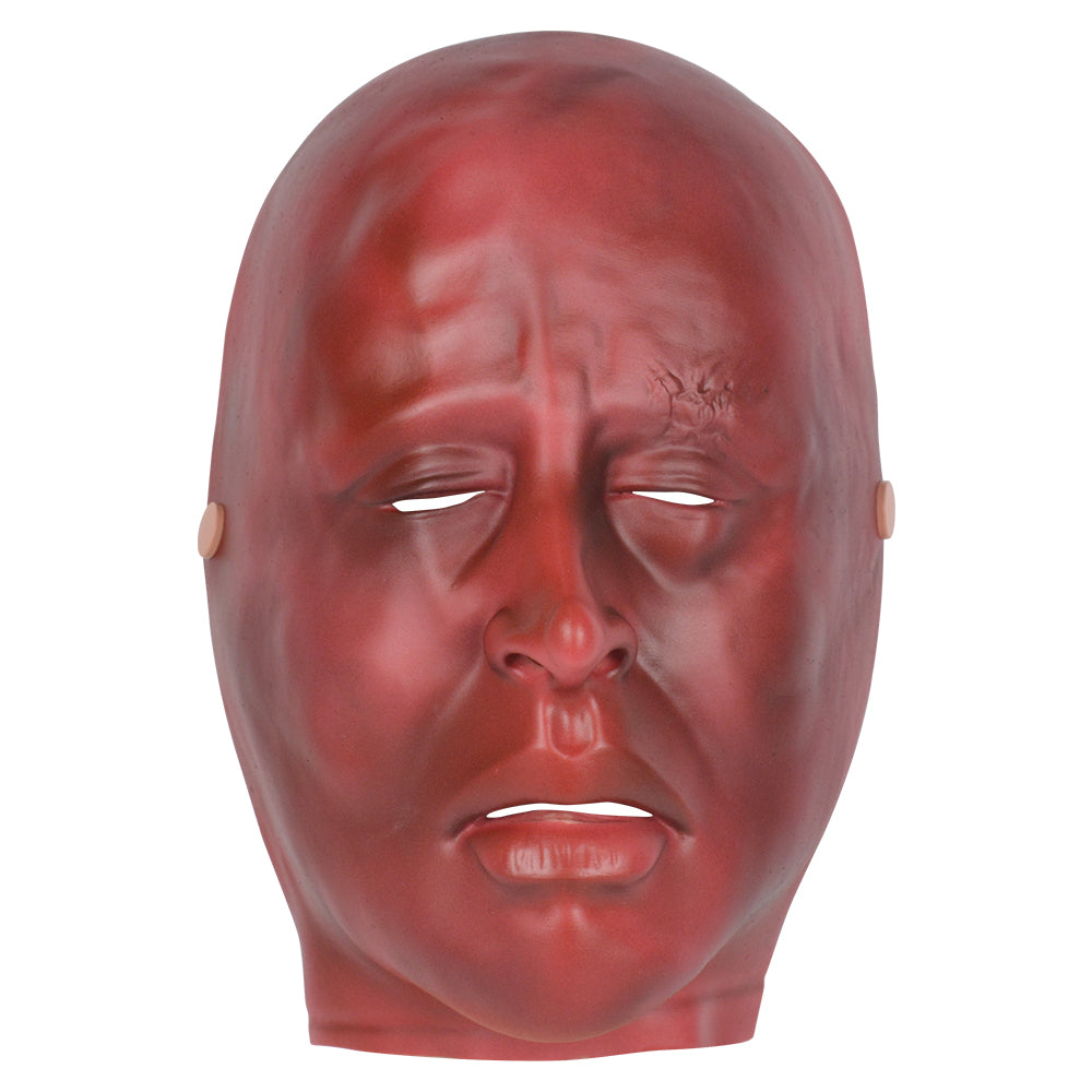 Severe Burn Face Moulage Used In Clinical Training