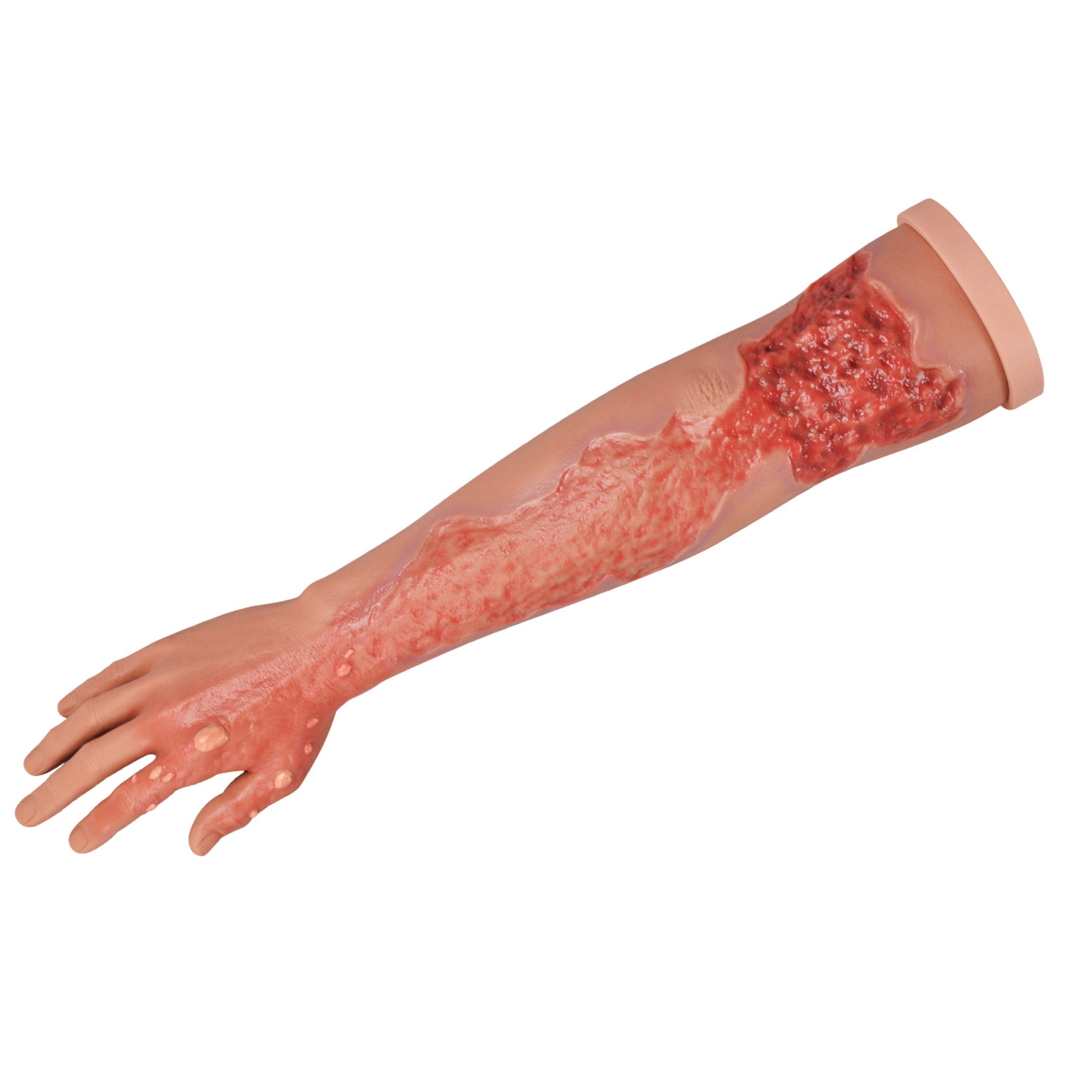 Severe Burn Wound Care Full Arm Training Model