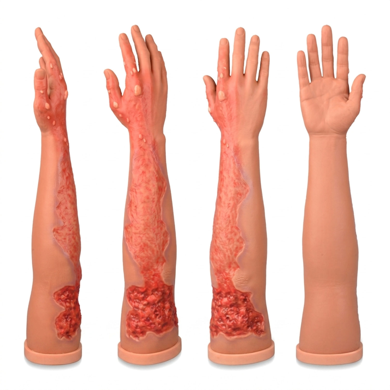Severe Burn Wound Care Full Arm Training Model