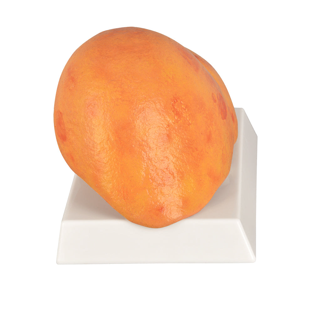 Silicone AFLD Liver Anatomy Replica