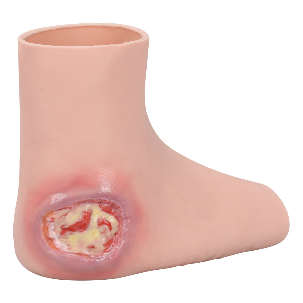 Silicone Heel Pressure Ulcer Wearable Foot Model