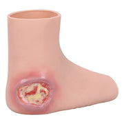 Silicone Heel Pressure Ulcer Wearable Foot Model