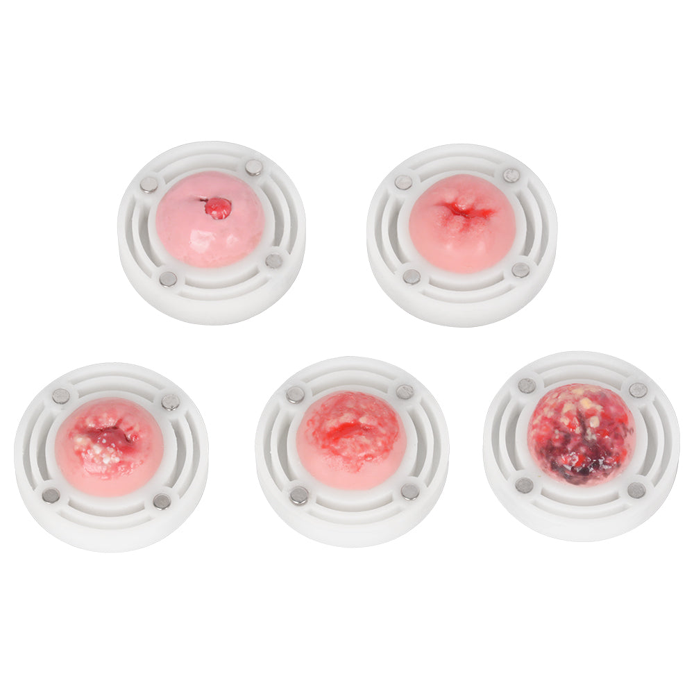 Six Interchangeable Cervical Modules Close Up