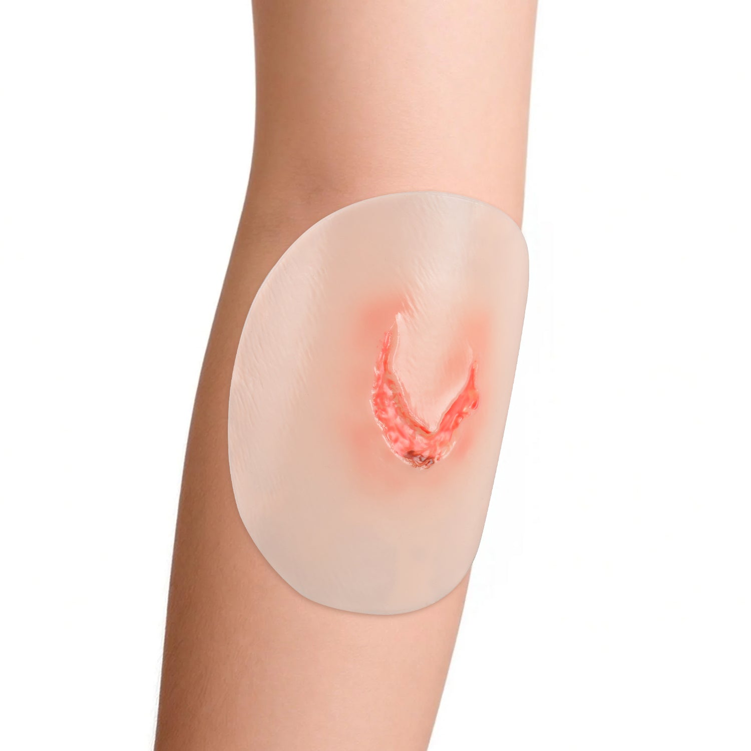 Skin Tear Wound Moulage Kit