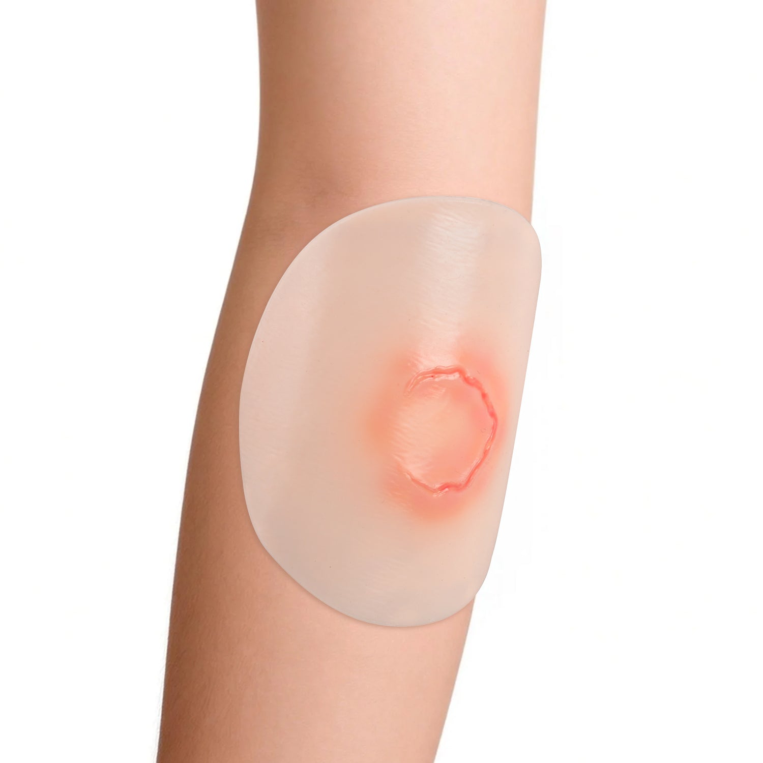 Skin Tear Wound Moulage Kit