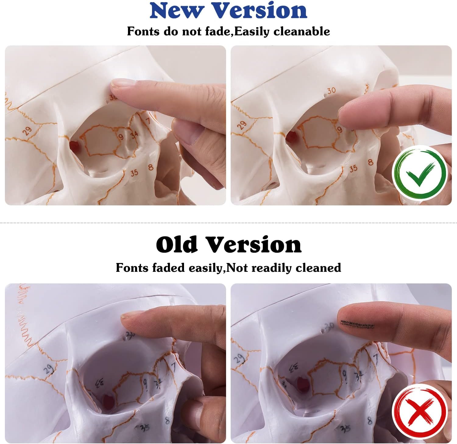 Skull Model Showing Cranial Vault And Base Parts