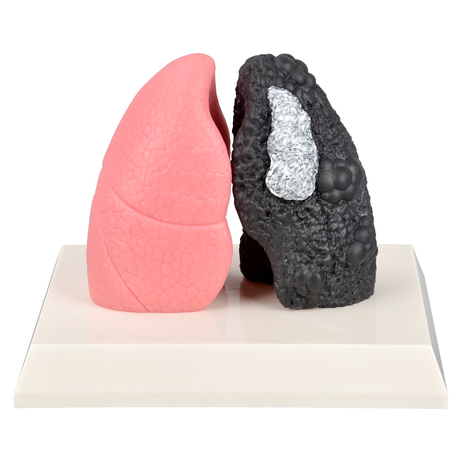 Smoker Lung Model with Healthy Lung Comparison