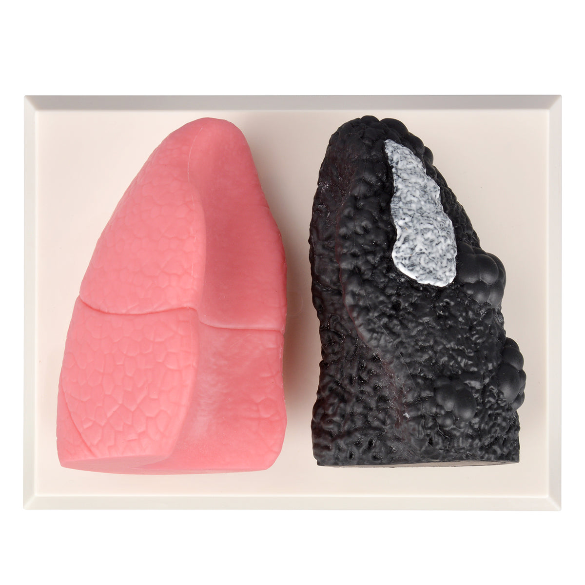 Smoker Lung Model with Healthy Lung Comparison