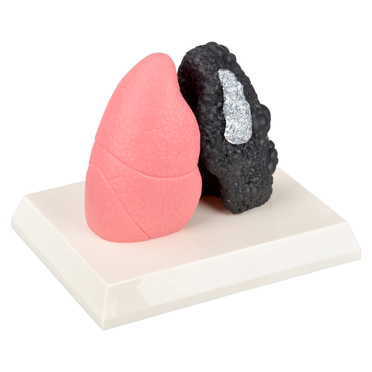 Smoker Lung Model with Healthy Lung Comparison