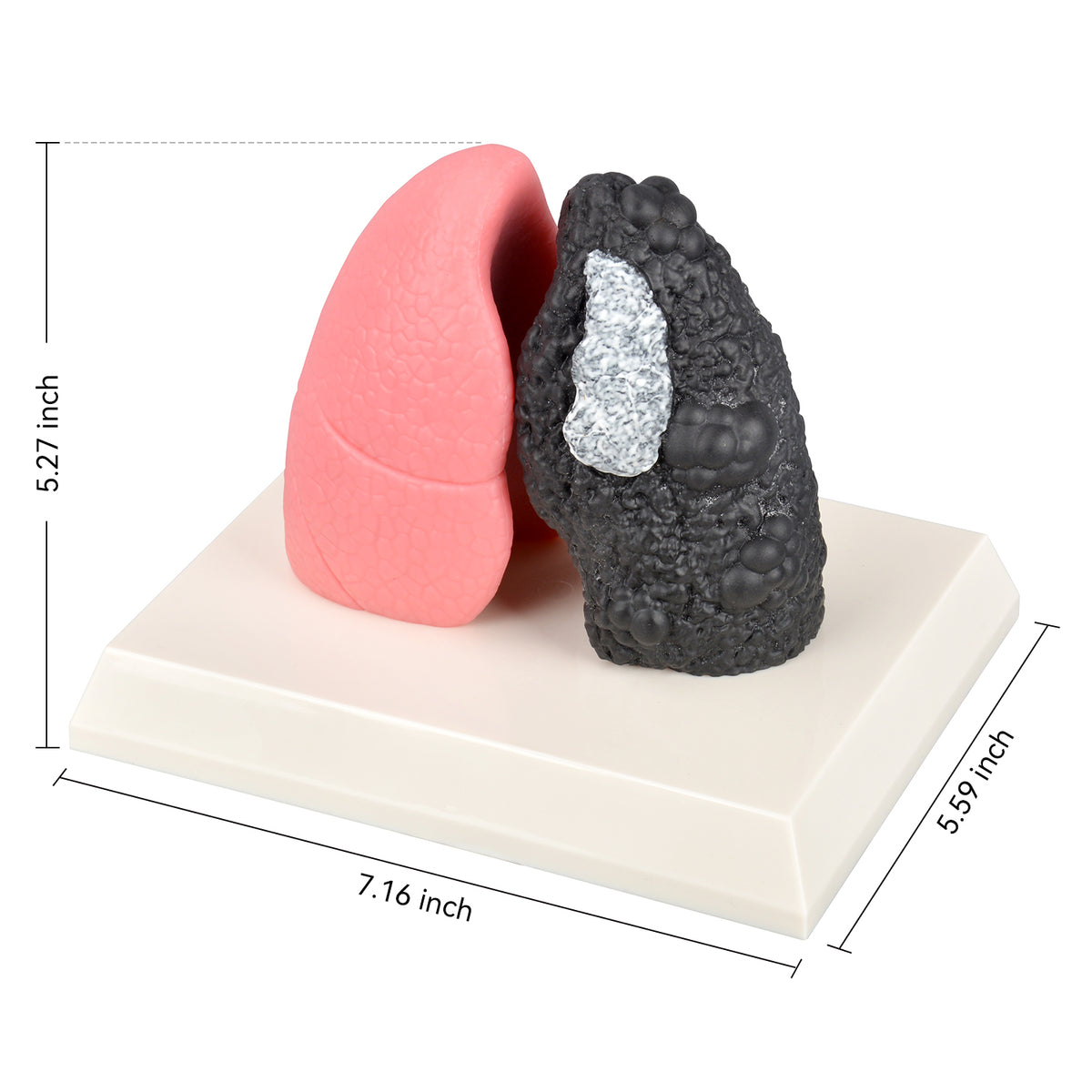 Smoker Lung Model with Healthy Lung Comparison