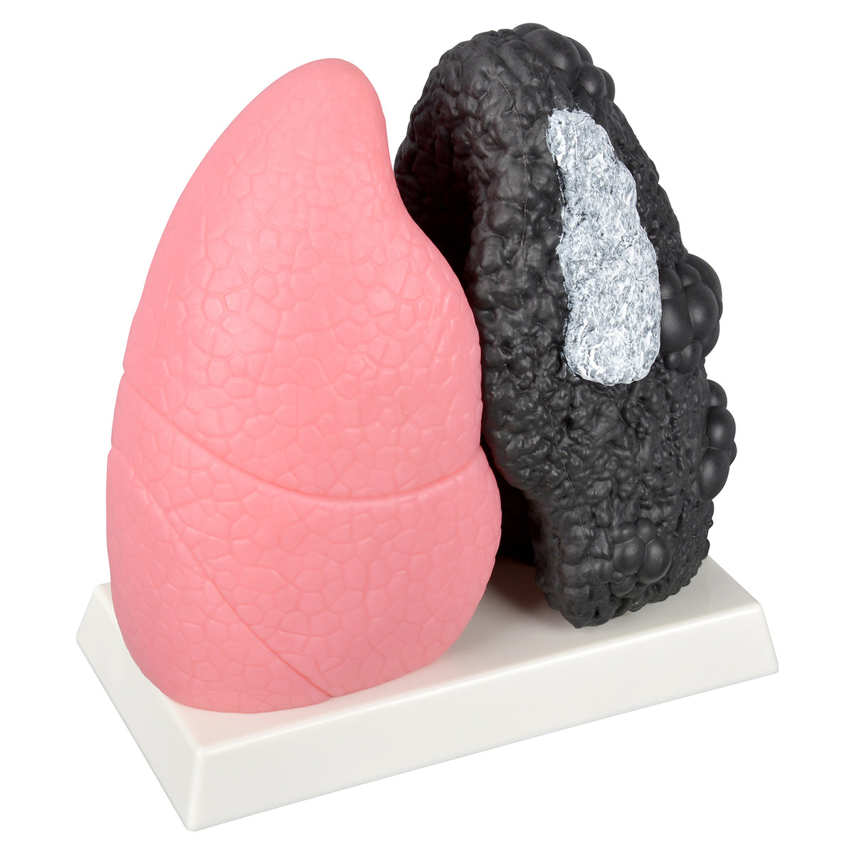 Smoker Lung Model with Healthy Lung Comparison