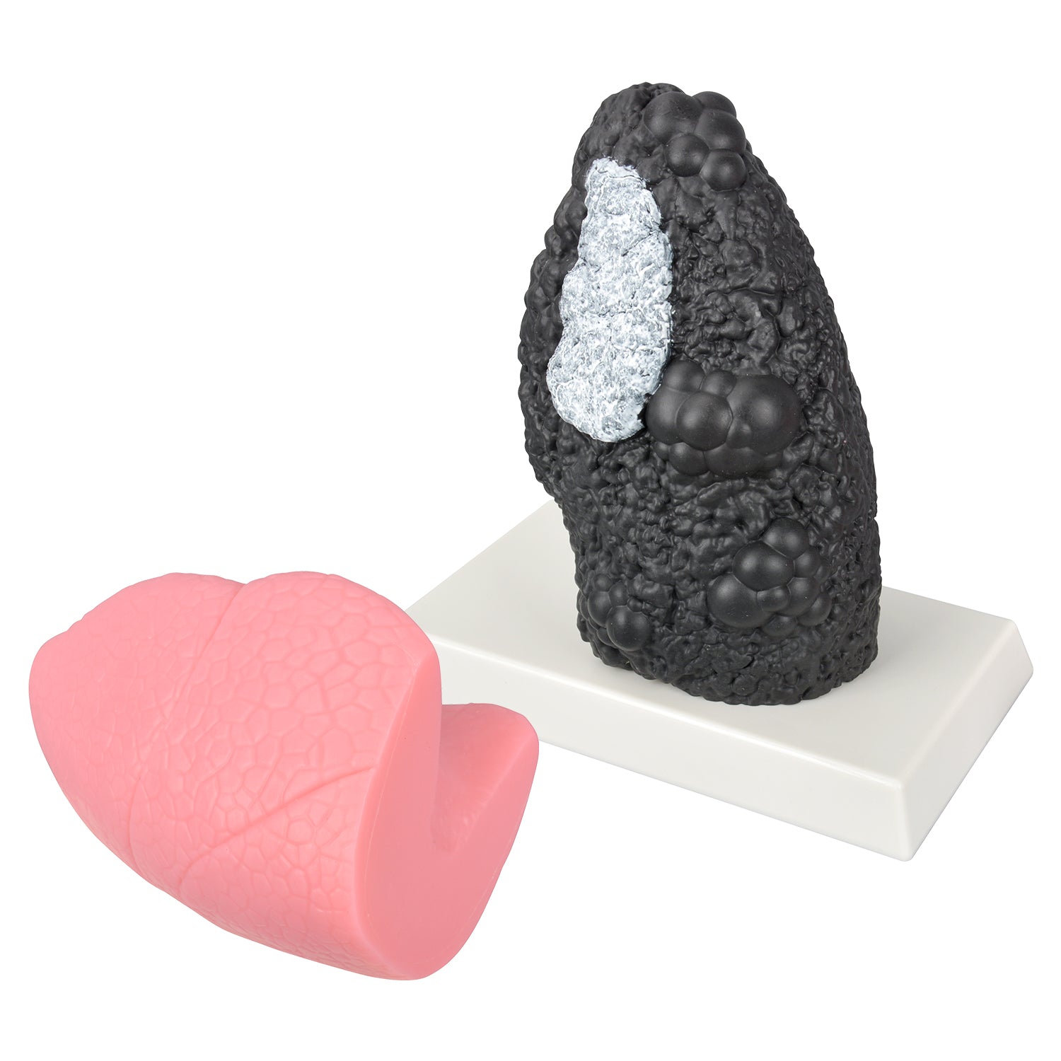 Smoker Lung Model with Healthy Lung Comparison