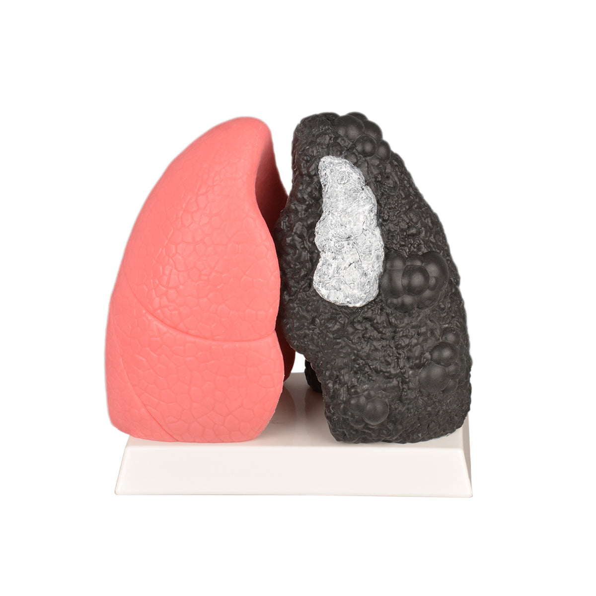Smoker Lung Model with Healthy Lung Comparison