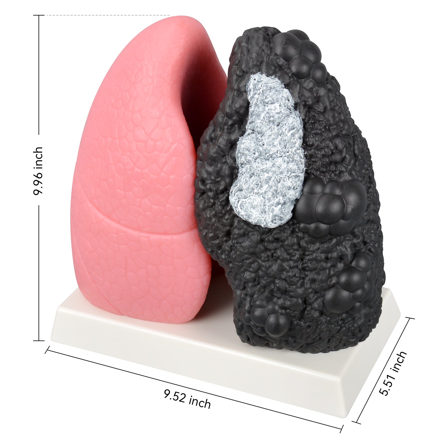 Smoker Lung Model with Healthy Lung Comparison
