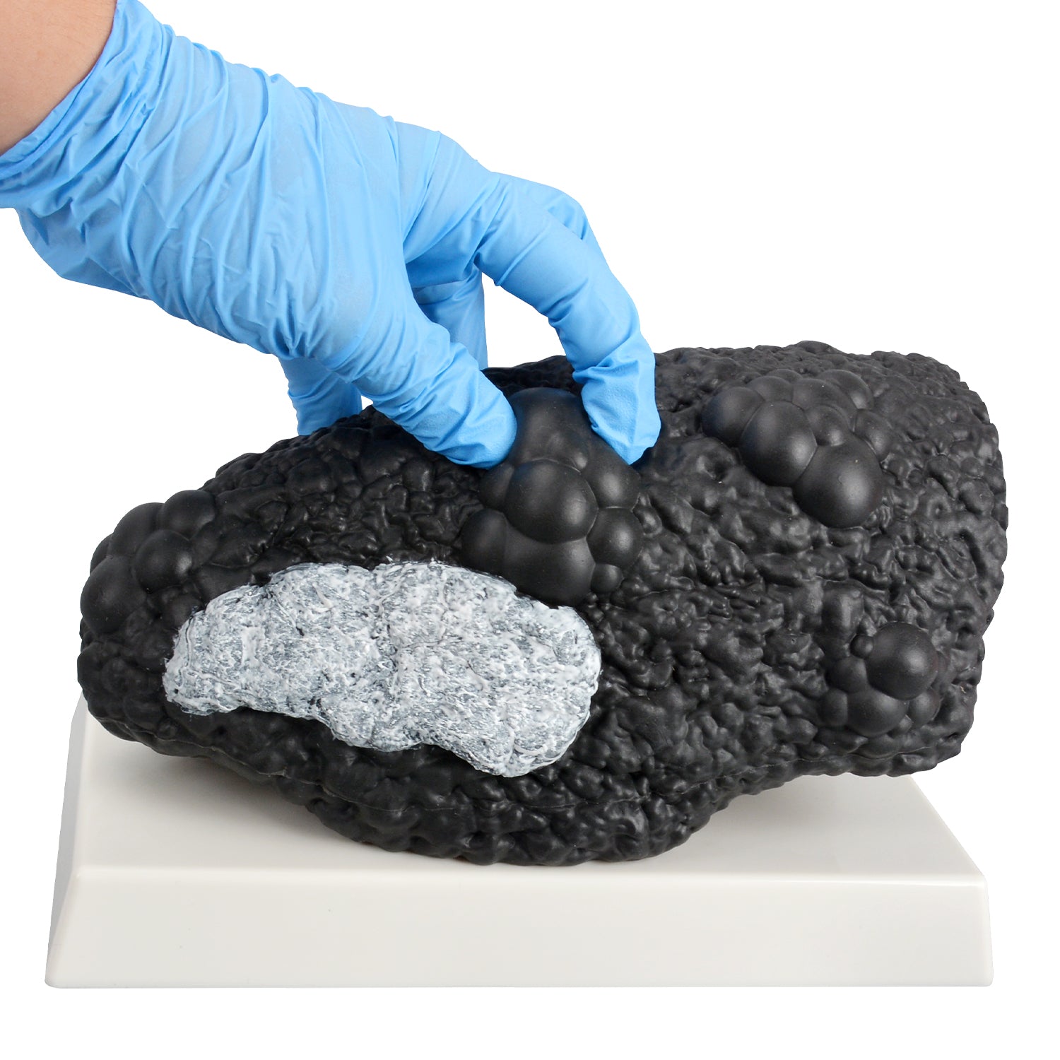 Smoker Lung Model with Healthy Lung Comparison