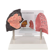 Smoker’s Lung Model