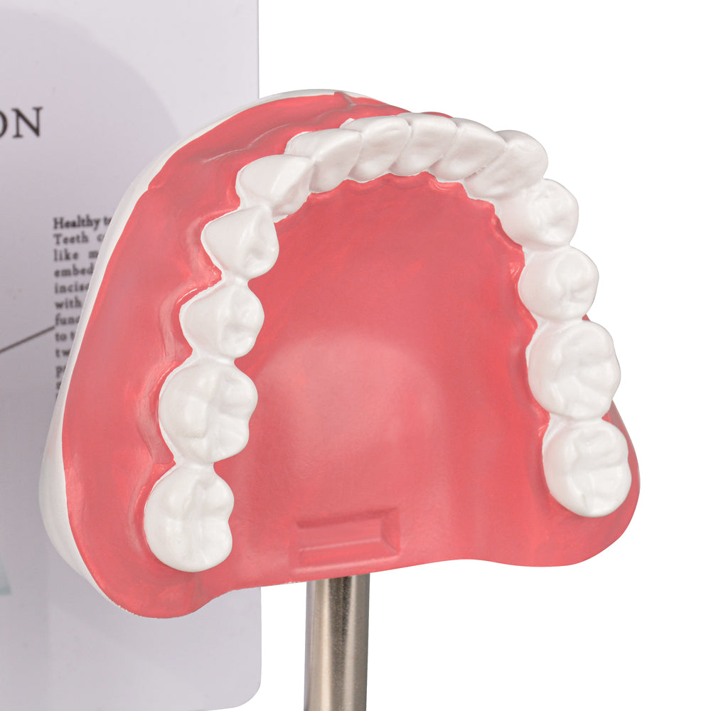 Smoking Damage Teeth Demonstration Mouth Model
