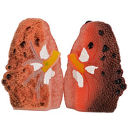 Smoking Lung Model with Cross-Section