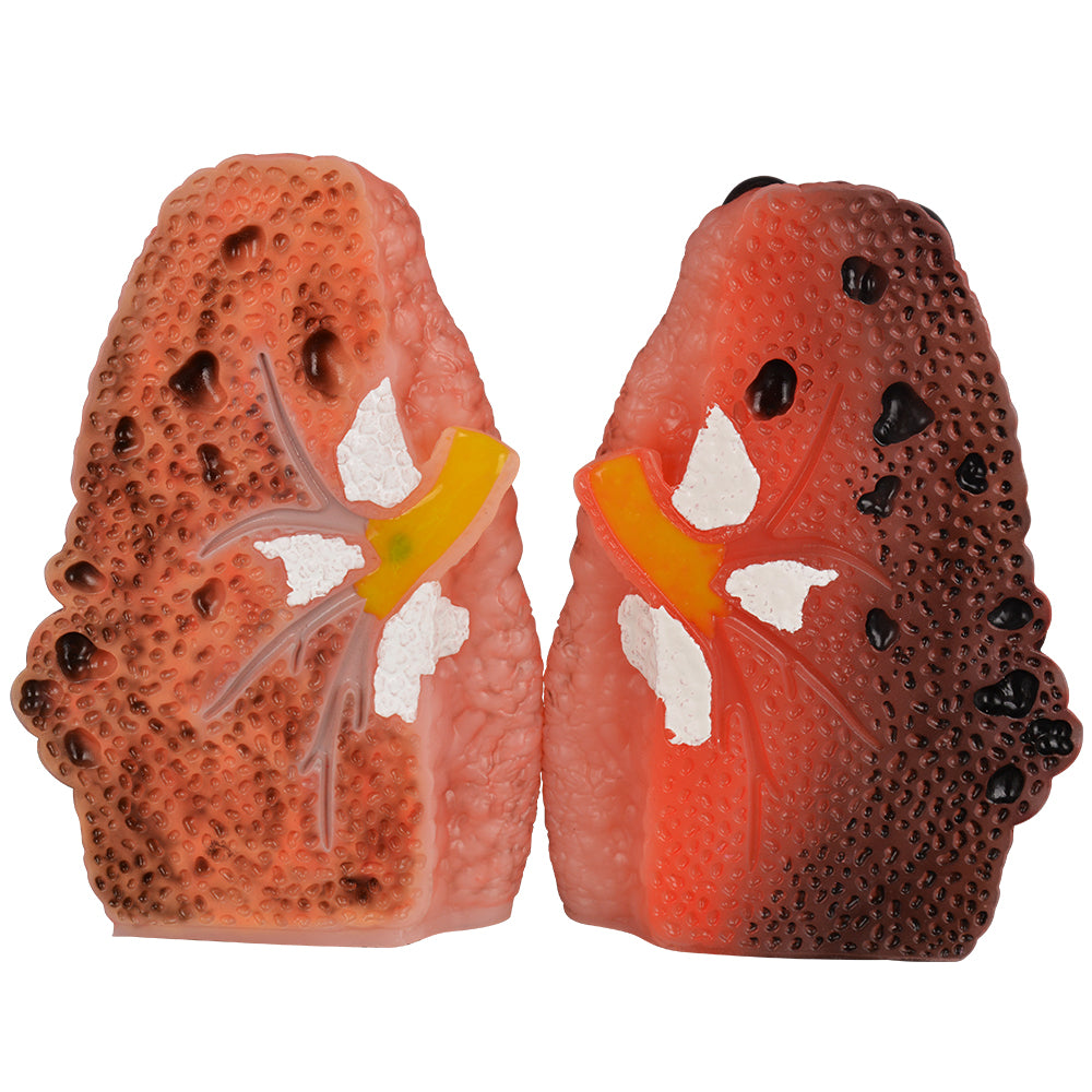 Smoking Lung Model with Cross-Section