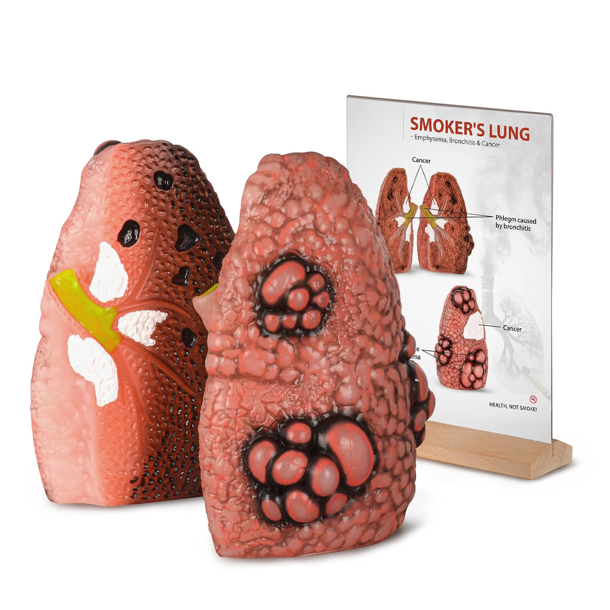 Smoking Lung Model with Cross-Section