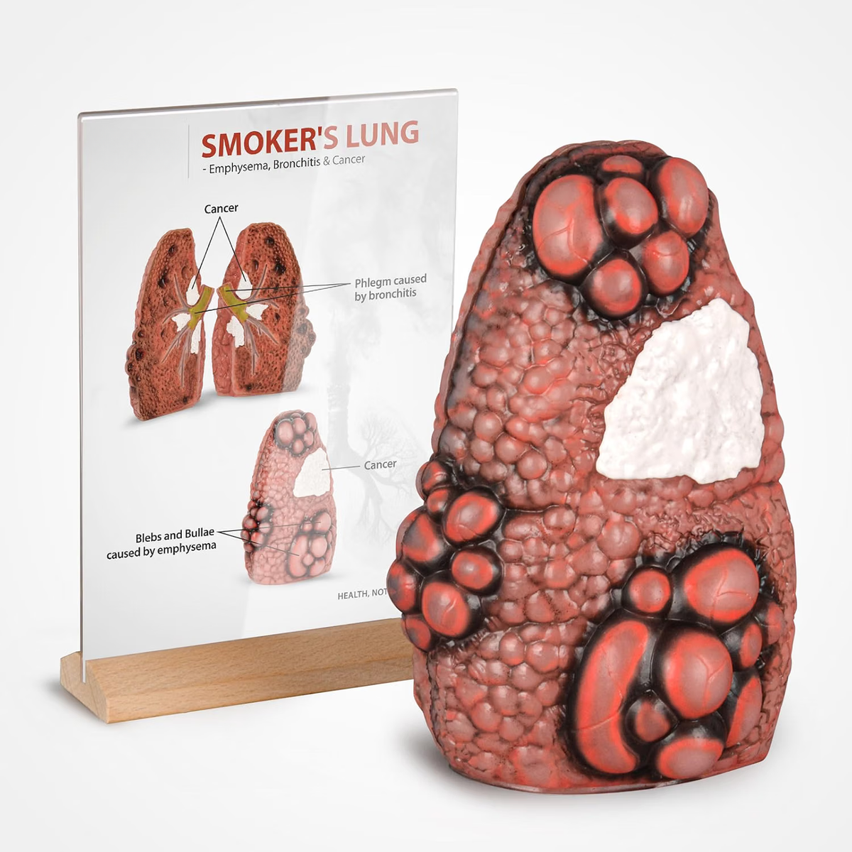 Smoking Lung Model with Cross-Section