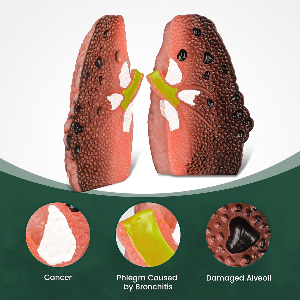 Smoking Lung Model with Cross-Section