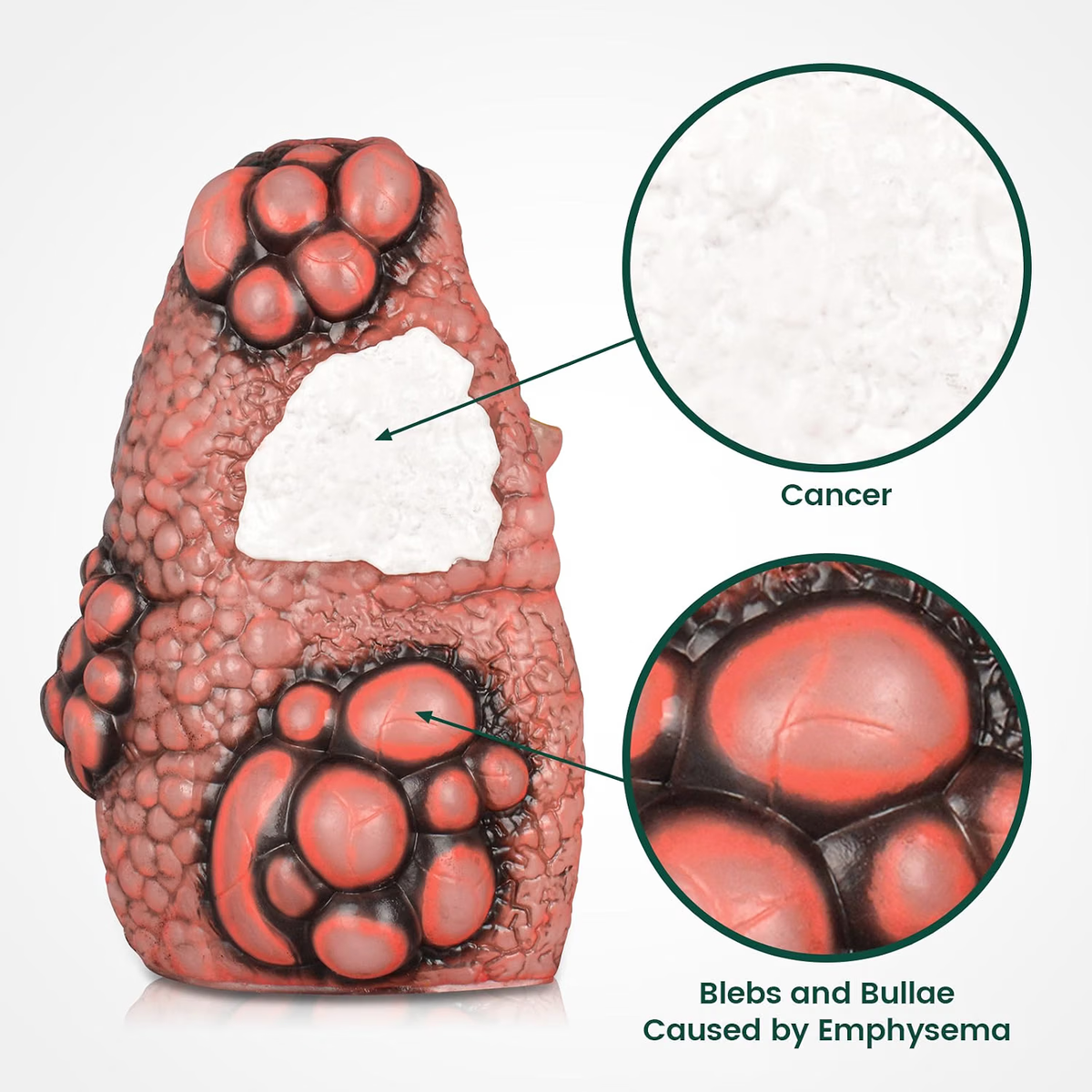 Smoking Lung Model with Cross-Section