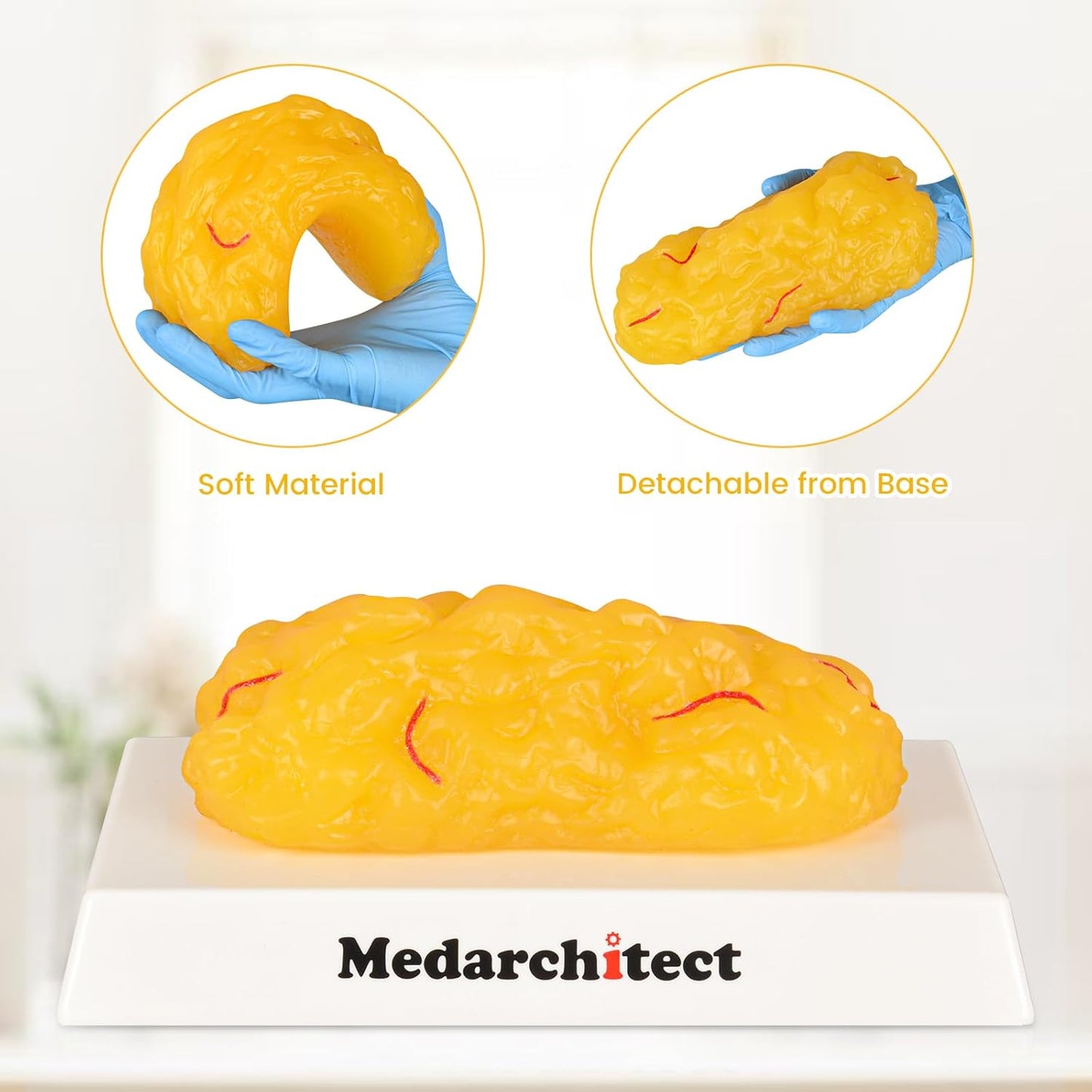 Soft Fat Model for Health and Fitness Motivation