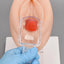 Speculum Demonstration on Vaginal Exam Model