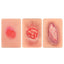 Stage 2-4 Pressure Ulcer Wound Simulation Model